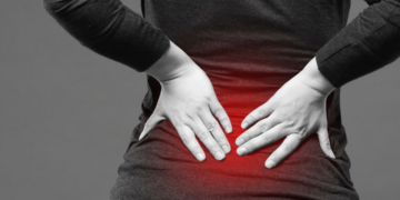 10 cose che devi sapere sul mal di schiena.
